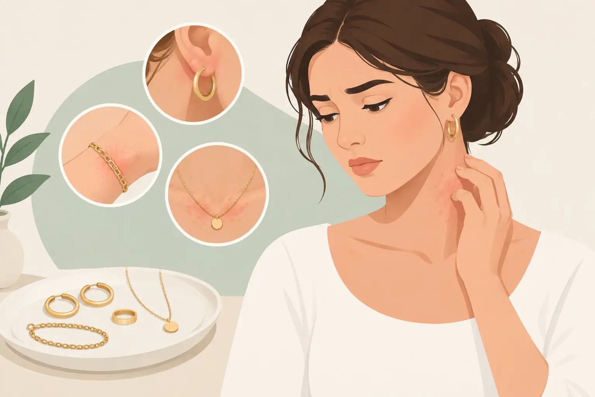 Jewellery Allergies and What Your Skin Is Telling You